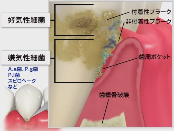 プラーク細菌